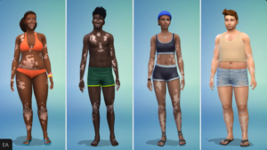 The Sims 4 Adds Vitiligo Skin Feature